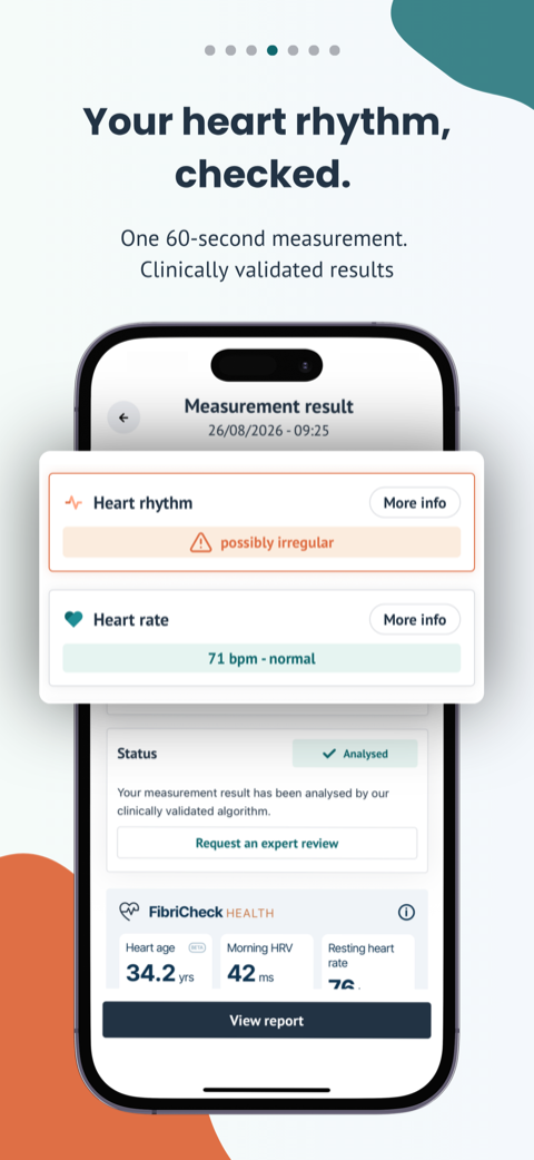 Your heart rhythm, checked. A heart rhythm result reading possibly irregular, a heart rate of 71 bpm, and an option to request an expert review.