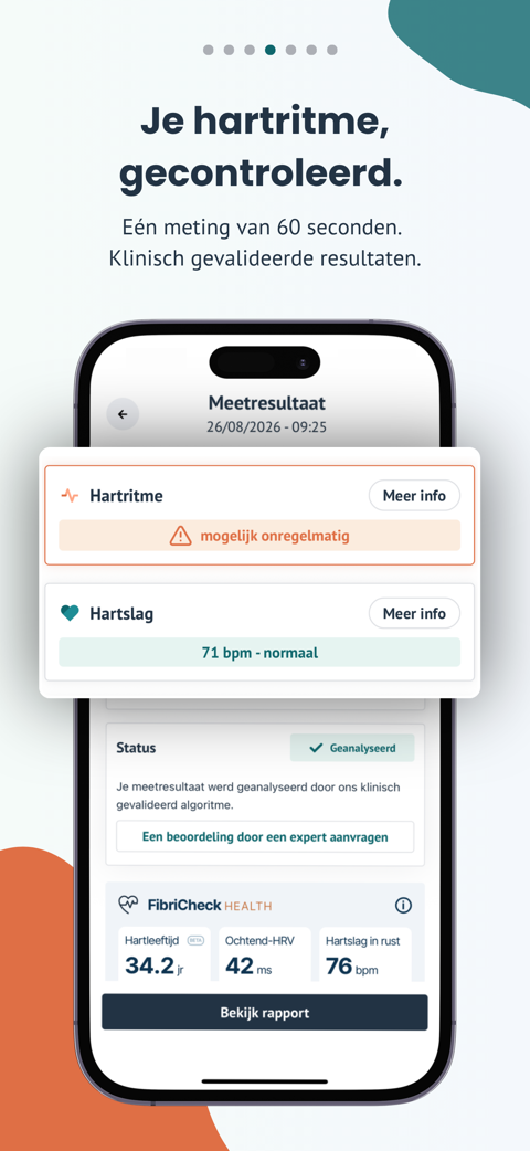 Je hartritme, gecontroleerd. Een hartritmeresultaat dat mogelijk onregelmatig aangeeft, een hartslag van 71 bpm, en de mogelijkheid om een beoordeling door een expert aan te vragen.