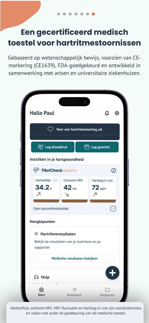 Het startscherm van de app met inzichten in je hartgezondheid, met de vermelding dat hartleeftijd, ochtend-HRV, HRV-fluctuatie en hartslag in rust welzijnsfuncties zijn en niet onder de goedkeuring van dit medische toestel vallen.