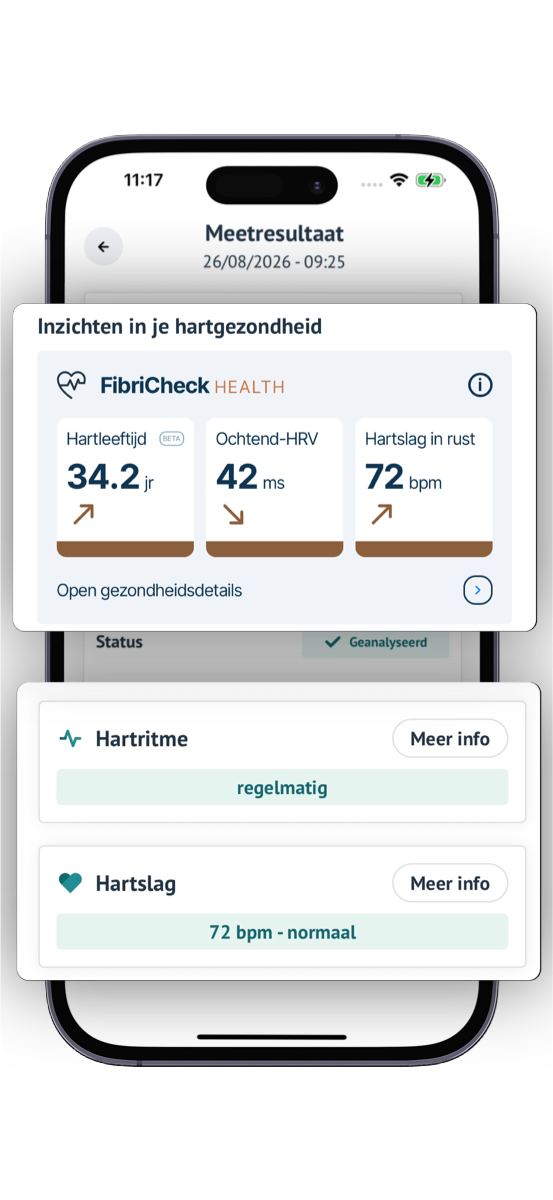 Een meetresultaat in FibriCheck met de gezondheidsinzichten (hartleeftijd 34,2 jaar, ochtend-HRV 42 ms, hartslag in rust 72 bpm) boven de medische resultaten: een regelmatig hartritme en een normale hartslag van 72 bpm.