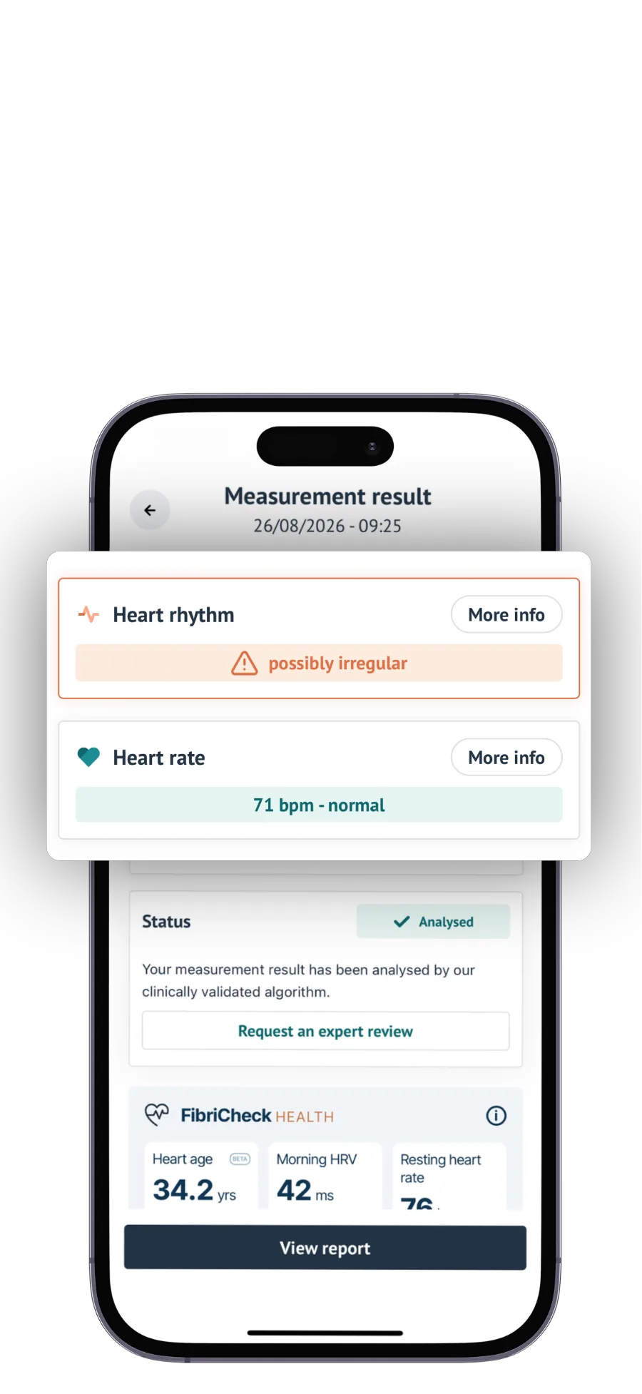 Measurement result showing heart rhythm and heart rate