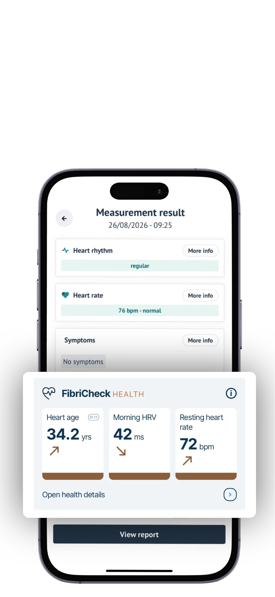 A regular rhythm result feeding the FibriCheck health insights