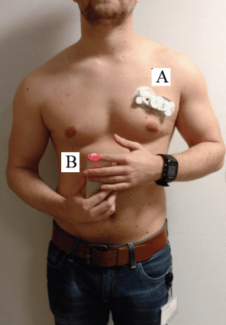 irregular heartbeat check fingertip