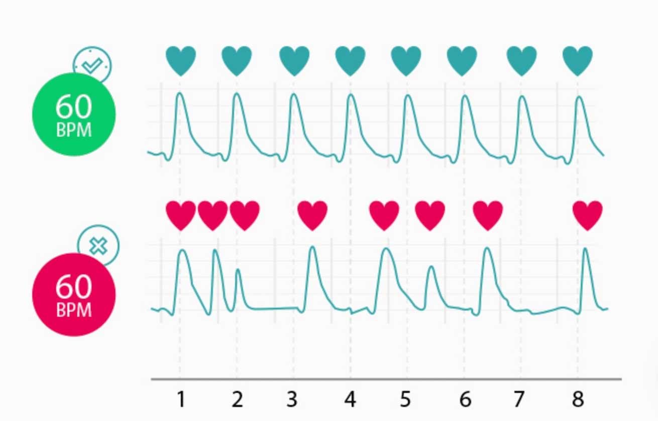 Heart rate versus heart rhythm