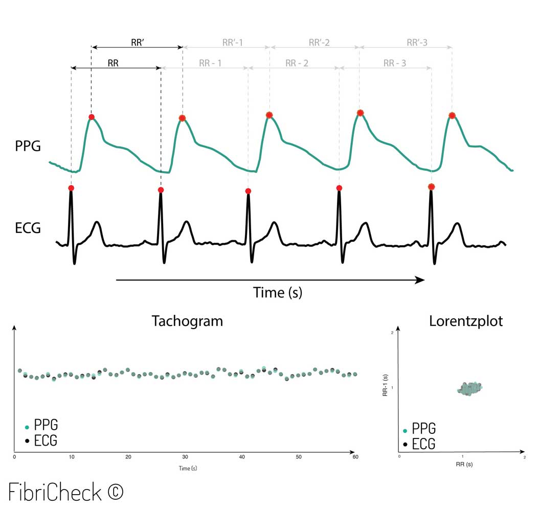 PPG ECG