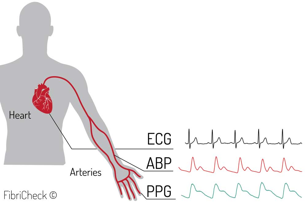 PPG ABP ECG