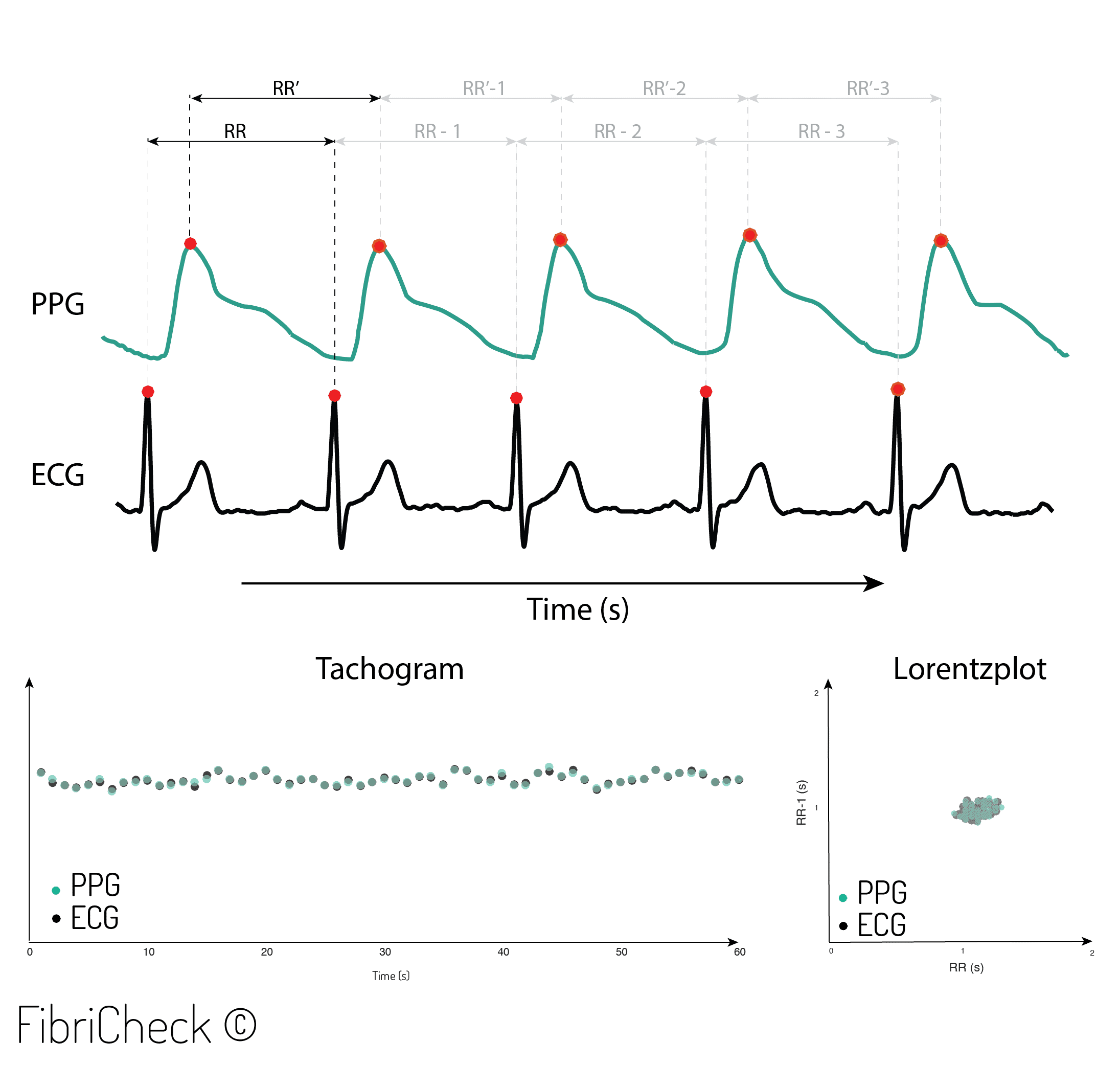 PPG ECG