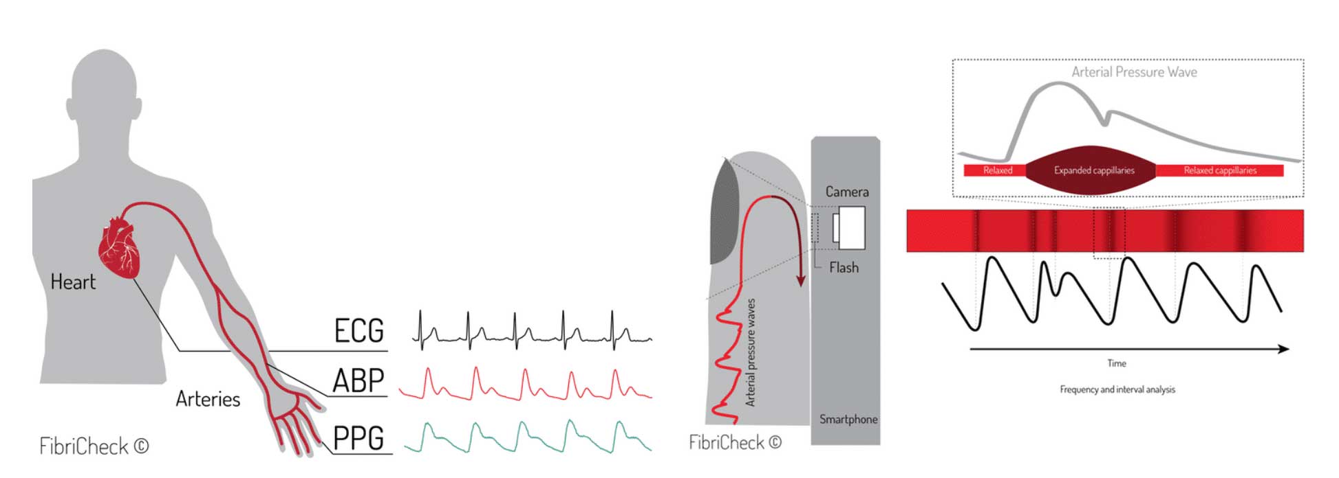 PPG ABP ECG