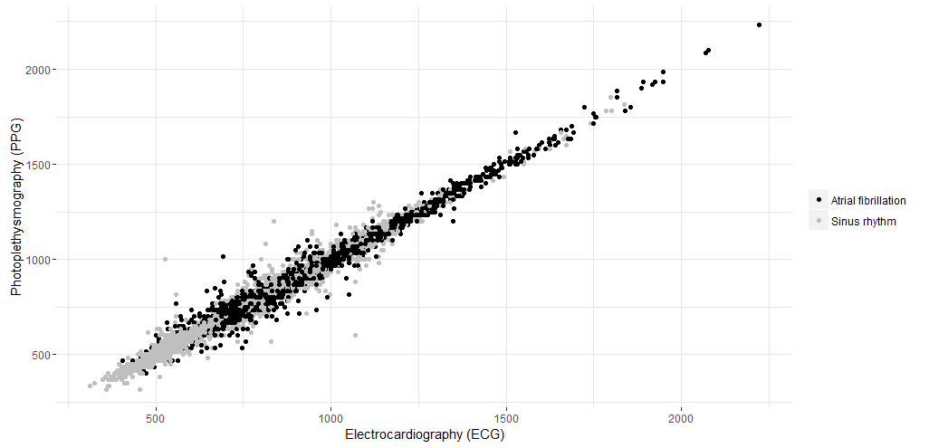 ecg and ppg