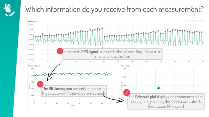 ppg visualisation graph