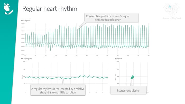 ppg visualisation graph