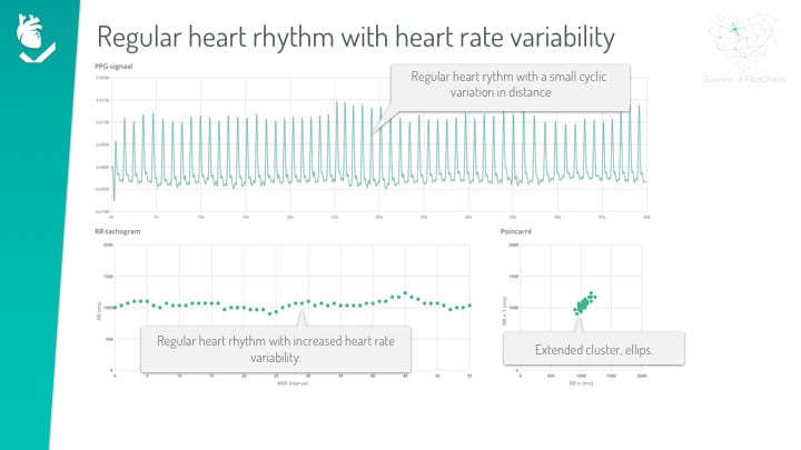 ppg visualisation graph