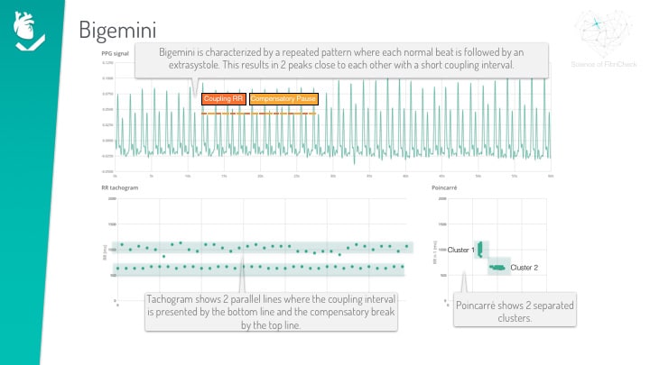 ppg visualisation graph