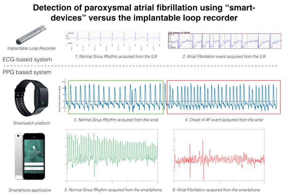 smart devices monitor heart